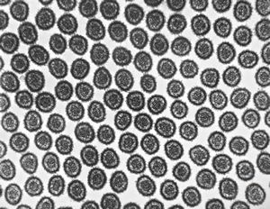 normal mucosa - jejunum - microvilli normal mucosa - jejunum - microvilli